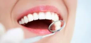 Tratamento de canal é necessário quando a polpa dentária (parte interna do dente) é infectada devido à cárie profunda ou trauma Dentista em CIDADE DEZ.