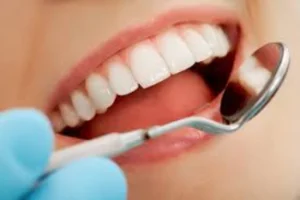 Aparelhos ortodônticos preventivos para correção precoce Dentista em CIDADE DEZ