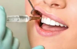 Tratamento de abscessos dentários e infecções Dentista em CIDADE DEZ