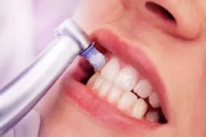 Cuidados odontológicos preventivos para gestantes Dentista em CIDADE DEZ