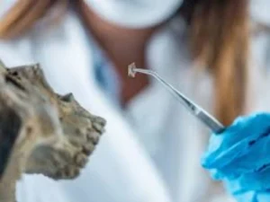 Vantagens do uso de laser em tratamentos odontológicos Dentista em CIDADE DEZ