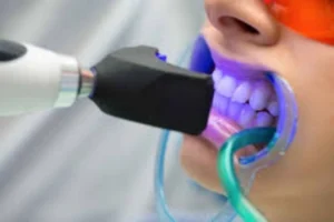 Uso de impressão 3D para criar guias cirúrgicos e próteses dentárias precisas Dentista em CIDADE DEZ