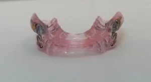 Orientação e cuidados com próteses dentárias em pacientes idosos Dentista em CIDADE DEZ