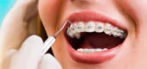 Cuidados especiais para prevenir complicações bucais em pacientes diabéticos Dentista em CIDADE DEZ