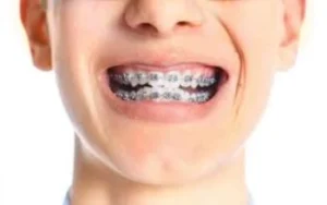 Tratamentos odontológicos seguros e eficazes para pacientes diabéticos Dentista em CIDADE DEZ